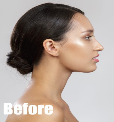 Before-Jaw Lift