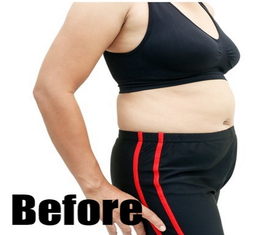 Before-Arm Reduction