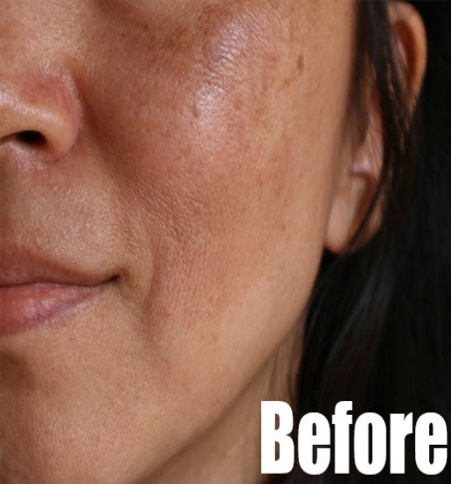 Before-BB Skin Glow