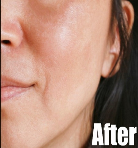 After-BB Skin Glow